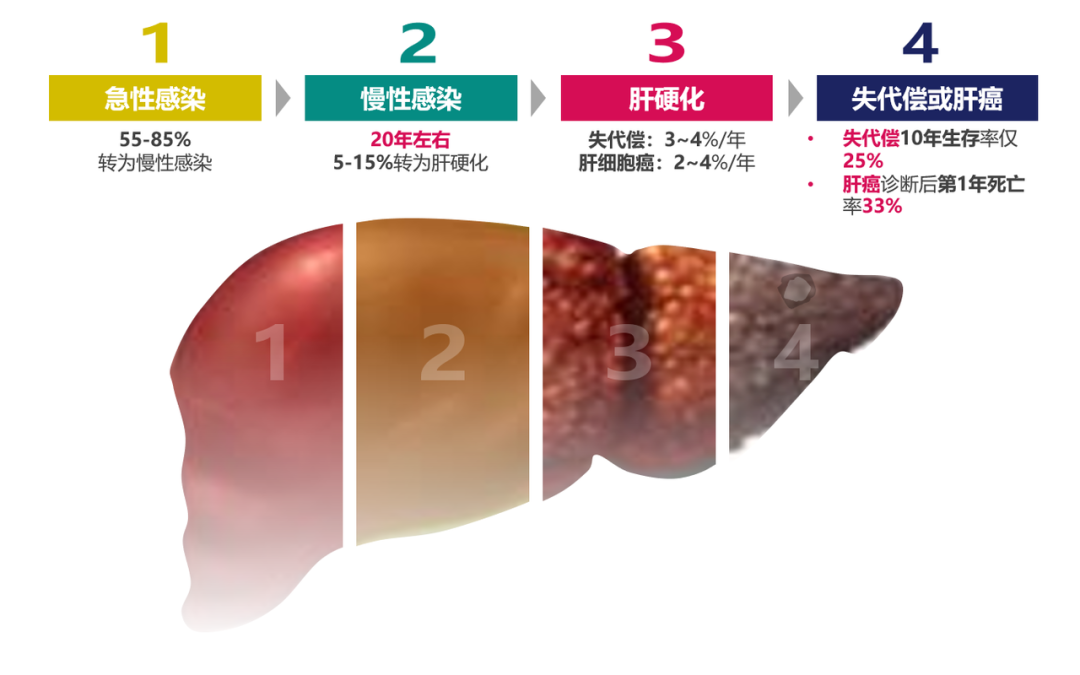 悄悄變成肝硬化、肝癌，很多人感染了卻不知道