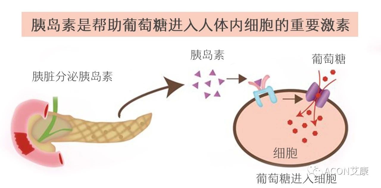 爆上熱搜，因爆發(fā)型糖尿病進入ICU，有哪些教訓(xùn)值得我們汲取