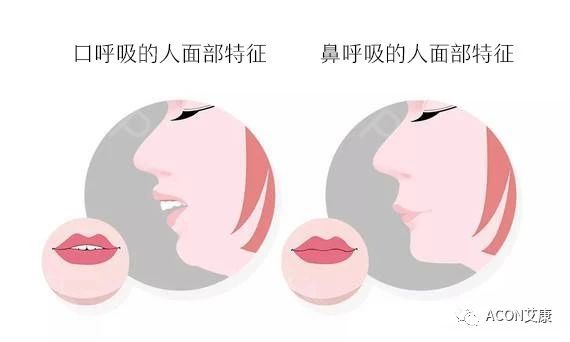 過敏性鼻炎會讓孩子變傻？！家長該如何應對